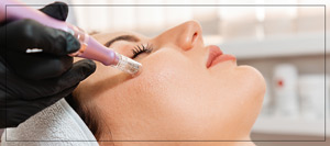 Benefits of Microneedling Treatment Near Me in Verona, NJ