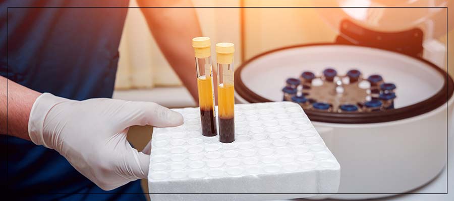 Platelet Rich Platelets (PRP) Therapy Specialist Near Me in Verona, NJ