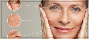 Minimally Invasive Laser Techniques for Loose & Wrinkled Skin Near Me in Verona, NJ