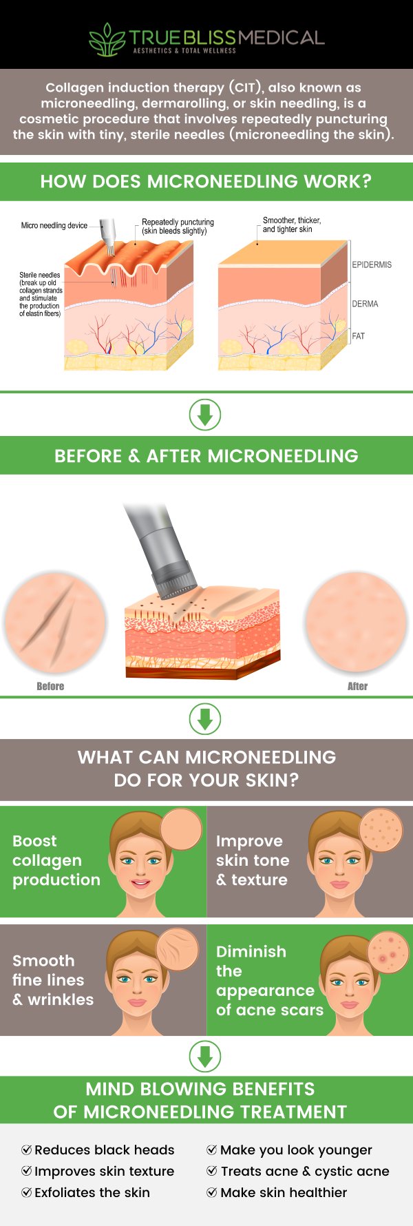 Microneedling stimulates collagen production, which helps rejuvenate the skin and restore its elasticity. This treatment also enhances skin texture and tone, making it ideal for targeting sun damage and enlarged pores. With little downtime, it offers noticeable improvements over time. It's safe for most skin types and can be customized based on individual needs. Visit True Bliss Medical Spa to get your microneedling treatment from Dr. Alexander Rios, MD. We can help you achieve your aesthetic goals. For more information, contact us or book an appointment online. We are conveniently located at 96 Pompton Ave Suite 102, Verona, NJ 07044.