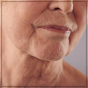 Skin Restoration Treatment Specialist Near Me in Verona, NJ