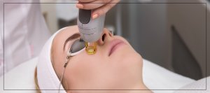 Benefits Of Combining RF Microneedling & Cool Peel CO2 Laser for Elevating Skin Rejuvenation Near Me in Verona, NJ