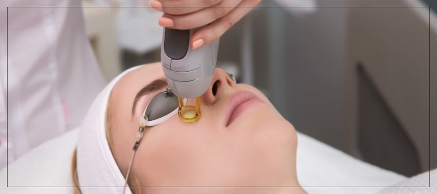 Tetra CoolPeel CO2 Laser Skin Resurfacing Specialist Near Me in Verona, NJ