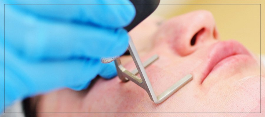 Transforming Skin Rejuvenation: The Power of Combining Radiofrequency Microneedling, CO2 Cool Peel Laser, and MSC Umbilical Exosomes in Verona, NJ