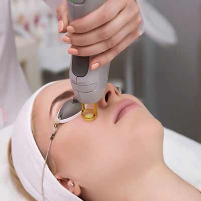 Tetra CO2 Cool Peel Laser Near Me in Verona, NJ