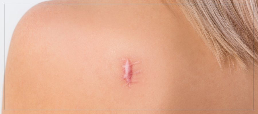 Kenalog Injections Specialist at True Bliss Medical in Verona, NJ