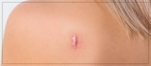 Kenalog Injections Specialist at True Bliss Medical in Verona, NJ