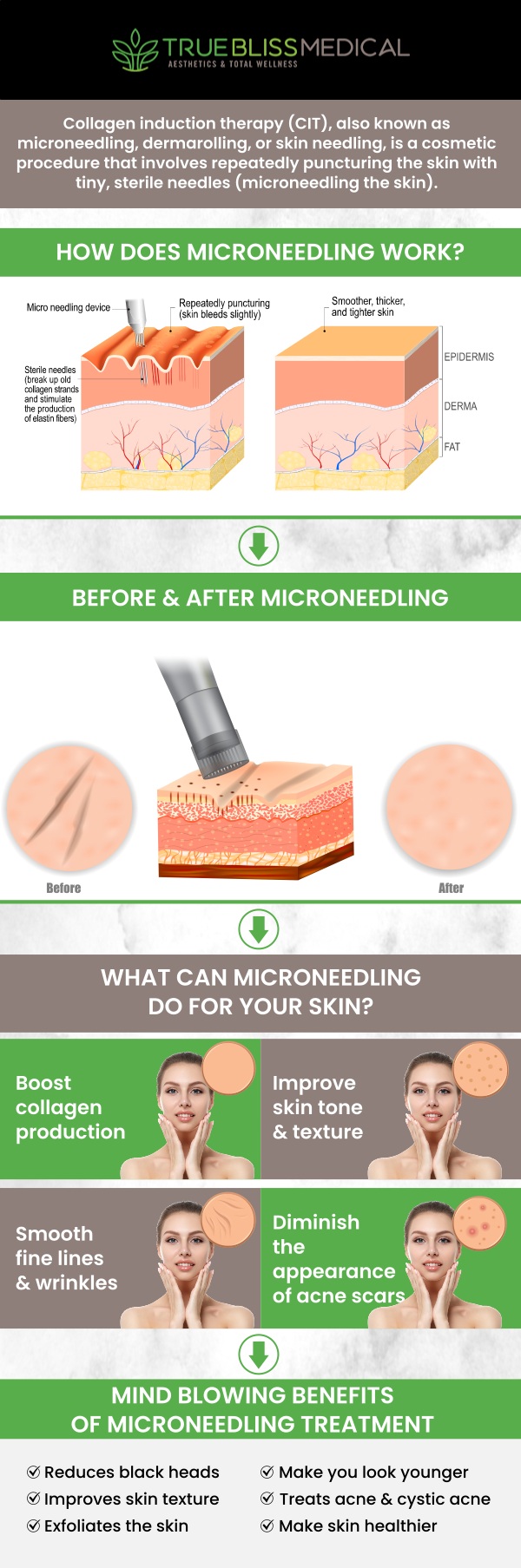 Microneedling is a non-surgical, minimally invasive treatment that helps rejuvenate your skin by stimulating collagen production. Using fine needles, our skilled professionals create micro-injuries in the skin, which trigger the body's natural healing process, leading to smoother, firmer, and more youthful-looking skin. At True Bliss Medical, Dr. Alexander Rios, MD personalize each treatment to meet your unique skin goals, ensuring natural-looking, lasting results. For more information, contact us today or request an appointment online. We are conveniently located at 96 Pompton Ave Suite 102, Verona, NJ 07044.