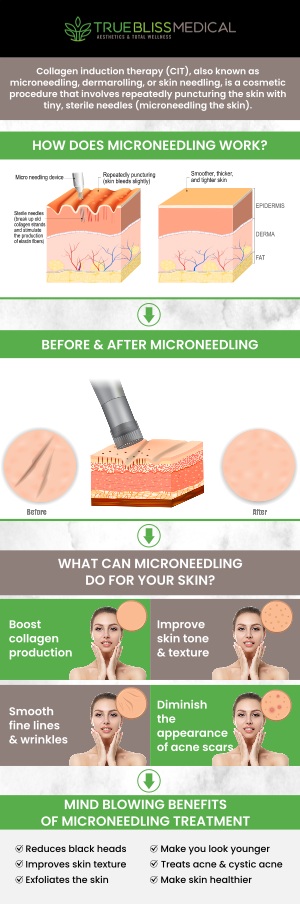 Microneedling is a non-surgical, minimally invasive treatment that helps rejuvenate your skin by stimulating collagen production. Using fine needles, our skilled professionals create micro-injuries in the skin, which trigger the body's natural healing process, leading to smoother, firmer, and more youthful-looking skin. At True Bliss Medical, Dr. Alexander Rios, MD personalize each treatment to meet your unique skin goals, ensuring natural-looking, lasting results. For more information, contact us today or request an appointment online. We are conveniently located at 96 Pompton Ave Suite 102, Verona, NJ 07044.