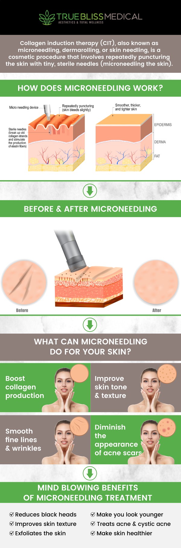 After your microneedling treatment at True Bliss Medical Spa with Dr. Alexander Rios, it's essential to follow proper aftercare guidelines for the best results. The skin may appear red or slightly swollen post-treatment, and it’s important to avoid direct sunlight, harsh skincare products, and excessive heat for 24-48 hours. By following these aftercare steps, you ensure your skin heals smoothly and achieves the rejuvenating effects of microneedling. For more information, contact us today or request an appointment online. We are conveniently located at 96 Pompton Ave Suite 102, Verona, NJ 07044.