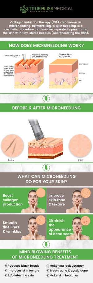 After your microneedling treatment at True Bliss Medical Spa with Dr. Alexander Rios, it's essential to follow proper aftercare guidelines for the best results. The skin may appear red or slightly swollen post-treatment, and it’s important to avoid direct sunlight, harsh skincare products, and excessive heat for 24-48 hours. By following these aftercare steps, you ensure your skin heals smoothly and achieves the rejuvenating effects of microneedling. For more information, contact us today or request an appointment online. We are conveniently located at 96 Pompton Ave Suite 102, Verona, NJ 07044.